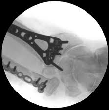 Surgery Consent Problems – Clarify Risks Before Signing Forms post thumbnail image